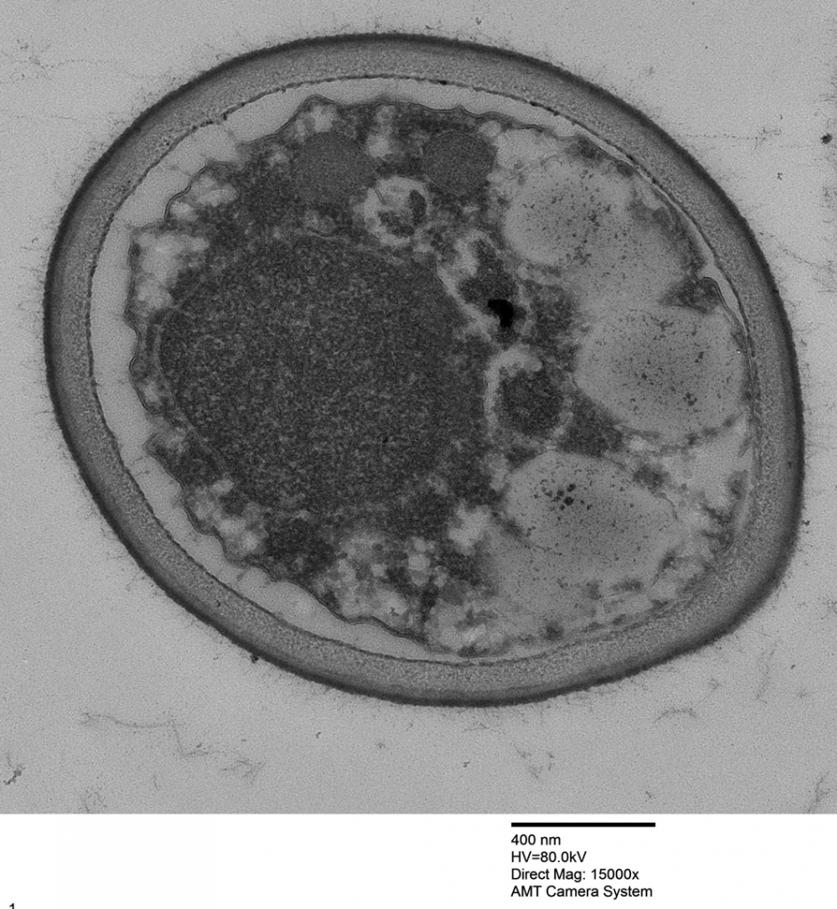 TEM micrograph of a Penicillium sp. spore